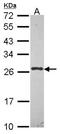 LIG antibody, NBP2-16831, Novus Biologicals, Western Blot image 