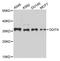 DNA Damage Inducible Transcript 4 antibody, A8086, ABclonal Technology, Western Blot image 