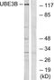 Ubiquitin Protein Ligase E3B antibody, A10679, Boster Biological Technology, Western Blot image 