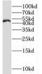 Notchless Homolog 1 antibody, FNab05754, FineTest, Western Blot image 