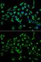 Cyclin-dependent kinase inhibitor 3 antibody, GTX55567, GeneTex, Immunofluorescence image 
