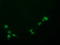 Pyrroline-5-Carboxylate Reductase 3 antibody, TA502077, Origene, Immunofluorescence image 