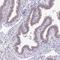 HLP antibody, HPA054419, Atlas Antibodies, Immunohistochemistry paraffin image 