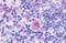 C-C Motif Chemokine Receptor Like 2 antibody, MBS247361, MyBioSource, Immunohistochemistry paraffin image 