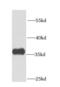 Coproporphyrinogen Oxidase antibody, FNab01868, FineTest, Western Blot image 