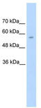 Dopa Decarboxylase antibody, TA346050, Origene, Western Blot image 