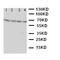 NADPH Oxidase 1 antibody, orb76180, Biorbyt, Western Blot image 