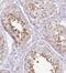 Ring Finger Protein 151 antibody, FNab07341, FineTest, Immunohistochemistry paraffin image 