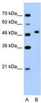Proline Rich 5 Like antibody, TA329476, Origene, Western Blot image 