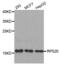 Ribosomal Protein S20 antibody, abx003015, Abbexa, Western Blot image 
