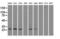 Hydroxysteroid 17-Beta Dehydrogenase 10 antibody, LS-C114888, Lifespan Biosciences, Western Blot image 