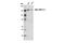 Myocardin Related Transcription Factor B antibody, 14613S, Cell Signaling Technology, Western Blot image 