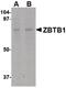 Zinc Finger And BTB Domain Containing 1 antibody, PA5-20653, Invitrogen Antibodies, Western Blot image 