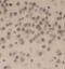 Histone-lysine N-methyltransferase SETD2 antibody, FNab07767, FineTest, Immunohistochemistry paraffin image 