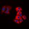 Tyrosine Hydroxylase antibody, orb224025, Biorbyt, Immunocytochemistry image 