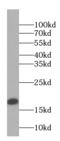 Salivary acidic proline-rich phosphoprotein 1/2 antibody, FNab06772, FineTest, Western Blot image 