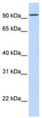 Dipeptidyl Peptidase Like 6 antibody, TA336001, Origene, Western Blot image 