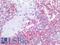 Lymphocyte Specific Protein 1 antibody, LS-B2190, Lifespan Biosciences, Immunohistochemistry paraffin image 