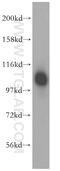 HAUS augmin-like complex subunit 6 antibody, 16933-1-AP, Proteintech Group, Western Blot image 