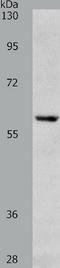Ribosomal Protein S6 Kinase B1 antibody, TA324276, Origene, Western Blot image 