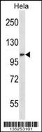 Zinc finger protein ZFPM2 antibody, 58-218, ProSci, Western Blot image 