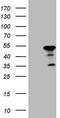 ATPase H+ Transporting V1 Subunit C2 antibody, TA808278, Origene, Western Blot image 