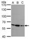Steroid Sulfatase antibody, GTX113628, GeneTex, Western Blot image 