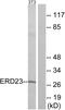 KDEL Endoplasmic Reticulum Protein Retention Receptor 3 antibody, GTX87279, GeneTex, Western Blot image 