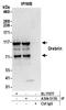 Drebrin 1 antibody, A304-517A, Bethyl Labs, Immunoprecipitation image 