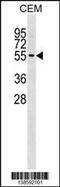 Scianna blood group antigen antibody, 59-961, ProSci, Western Blot image 