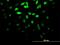 Dual Specificity Phosphatase 5 antibody, H00001847-M03, Novus Biologicals, Immunocytochemistry image 