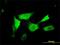 N-Acylethanolamine Acid Amidase antibody, H00027163-M01, Novus Biologicals, Immunocytochemistry image 