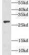 Glutathione S-Transferase Omega 2 antibody, FNab03698, FineTest, Western Blot image 