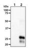 Potassium Channel Tetramerization Domain Containing 15 antibody, NBP1-49429, Novus Biologicals, Western Blot image 