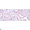 HPV11 E7 antibody, LS-C812444, Lifespan Biosciences, Immunohistochemistry paraffin image 