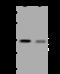 Protein Phosphatase 1 Regulatory Subunit 3F antibody, 206170-T36, Sino Biological, Western Blot image 