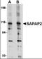 DLG Associated Protein 2 antibody, orb89820, Biorbyt, Western Blot image 