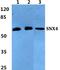 Sorting Nexin 4 antibody, PA5-37062, Invitrogen Antibodies, Western Blot image 