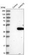 1-Acylglycerol-3-Phosphate O-Acyltransferase 5 antibody, HPA010644, Atlas Antibodies, Western Blot image 