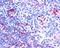 Syntaxin Binding Protein 6 antibody, orb18598, Biorbyt, Immunohistochemistry paraffin image 
