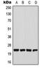 ChaC Glutathione Specific Gamma-Glutamylcyclotransferase 1 antibody, LS-C353541, Lifespan Biosciences, Western Blot image 