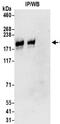 Leucyl And Cystinyl Aminopeptidase antibody, NBP2-32111, Novus Biologicals, Western Blot image 
