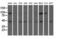 Aldehyde Dehydrogenase 1 Family Member L1 antibody, GTX84897, GeneTex, Western Blot image 