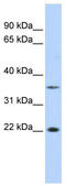 Cilia And Flagella Associated Protein 20 antibody, TA343704, Origene, Western Blot image 
