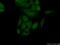 Integrin Subunit Beta 3 Binding Protein antibody, 10743-1-AP, Proteintech Group, Immunofluorescence image 