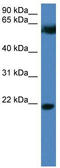 F-Box Protein 32 antibody, TA338809, Origene, Western Blot image 