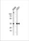 ASB-9 antibody, TA325070, Origene, Western Blot image 