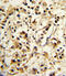 Killer cell immunoglobulin-like receptor 2DL4 antibody, 63-756, ProSci, Immunohistochemistry paraffin image 