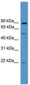 Ornithine decarboxylase antizyme 3 antibody, TA335566, Origene, Western Blot image 