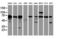 Sec1 family domain-containing protein 1 antibody, LS-C337720, Lifespan Biosciences, Western Blot image 